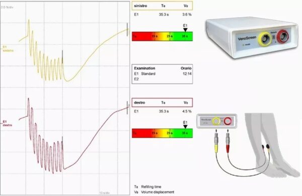 VENOSCREEN misuratore dell'insufficienza venosa - immagine 3